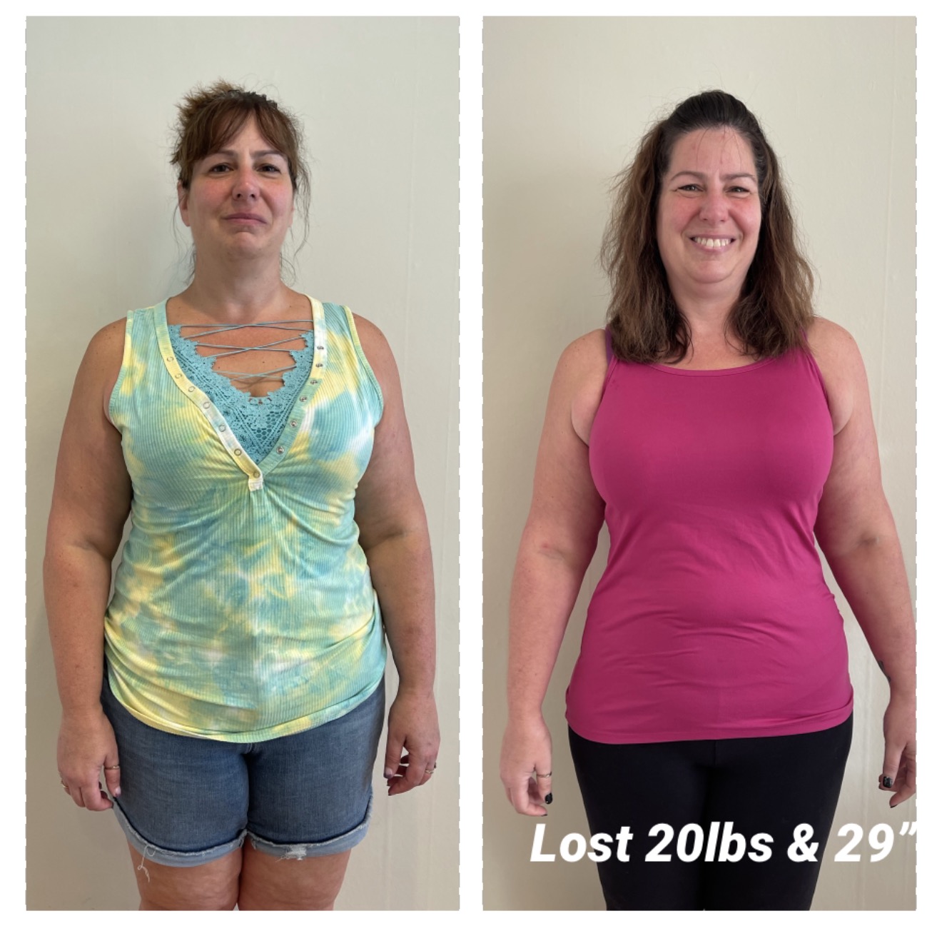Before and after photos of Donna B., who lost 25 lbs and 23 inches on ChiroThin
